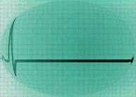 Encefalogramma piatto